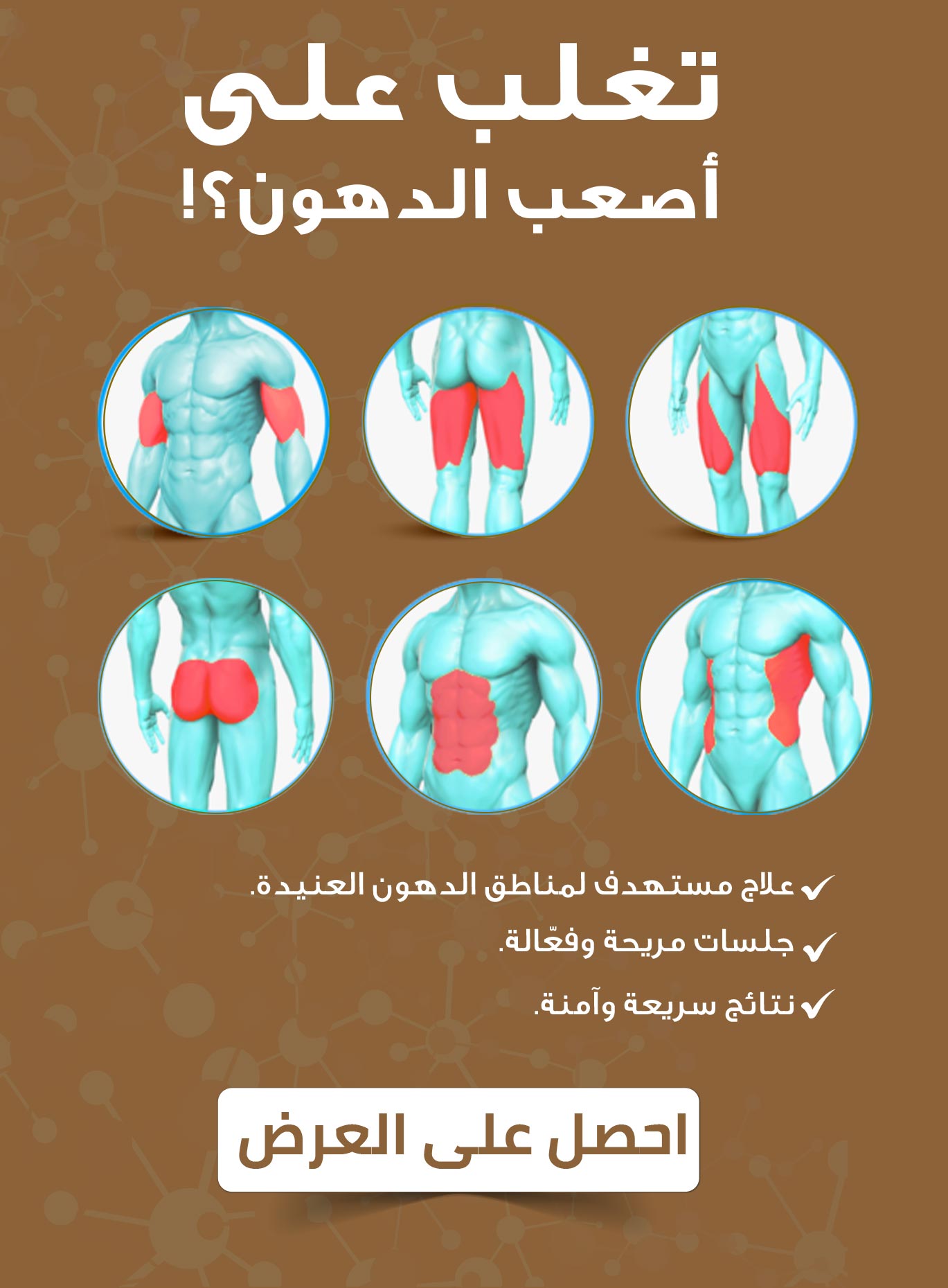 مناطق الدهون العنيدة في الجسم موضّحة بصريًا مع إعلان ترويجي لجهاز Lipo Zero للتنحيف.