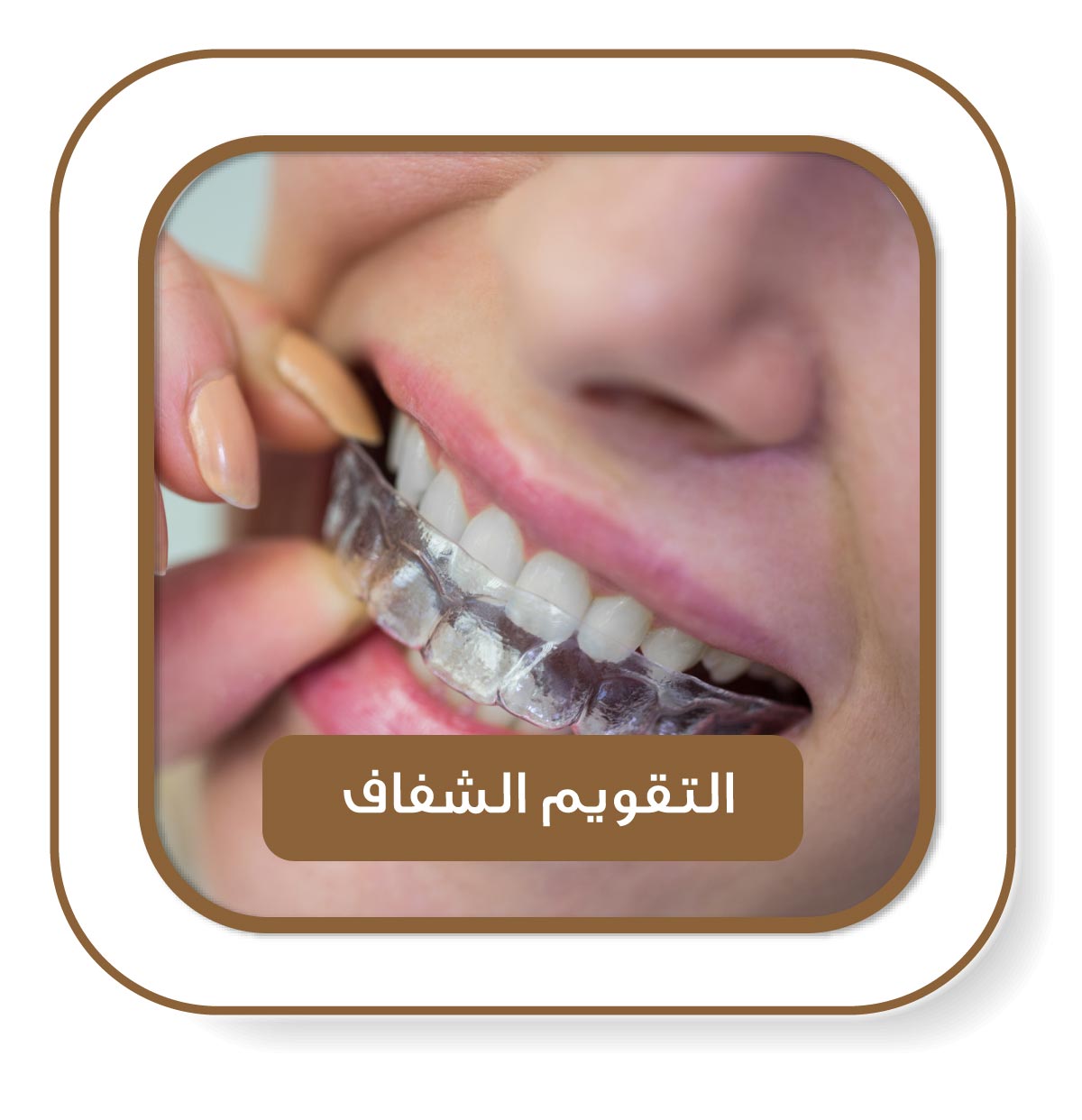 امرأة تضع جهاز تقويم شفاف على أسنانها باستخدام يدها، في إطار أنيق يوحي بالخدمة الطبية المتقدمة لتقويم الأسنان.**