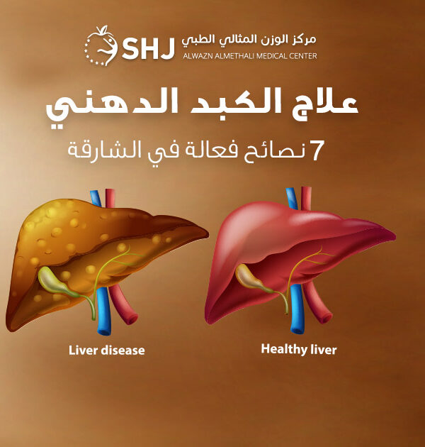علاج الكبد الدهني – تصميم توعوي يبيّن مقارنة بين كبد مريض وكبد سليم مع شعار مركز الوزن المثالي الطبي وأرقام التواصل؛ 7 نصائح فعّالة في الشارقة