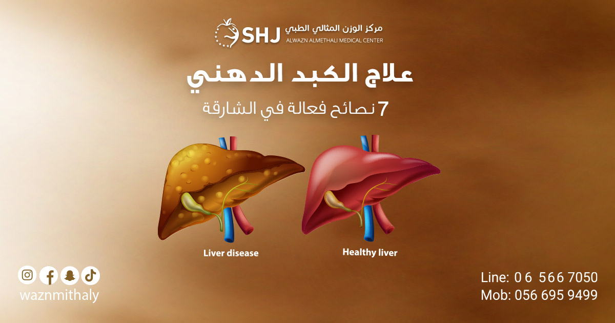 علاج الكبد الدهني – تصميم توعوي يبيّن مقارنة بين كبد مريض وكبد سليم مع شعار مركز الوزن المثالي الطبي وأرقام التواصل؛ 7 نصائح فعّالة في الشارقة