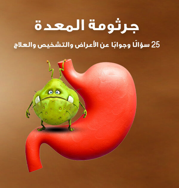 جرثومة المعدة: 25 سؤالًا وجوابًا عن الأعراض والتشخيص والعلاج، دليل مبسّط مع رسم توضيحي