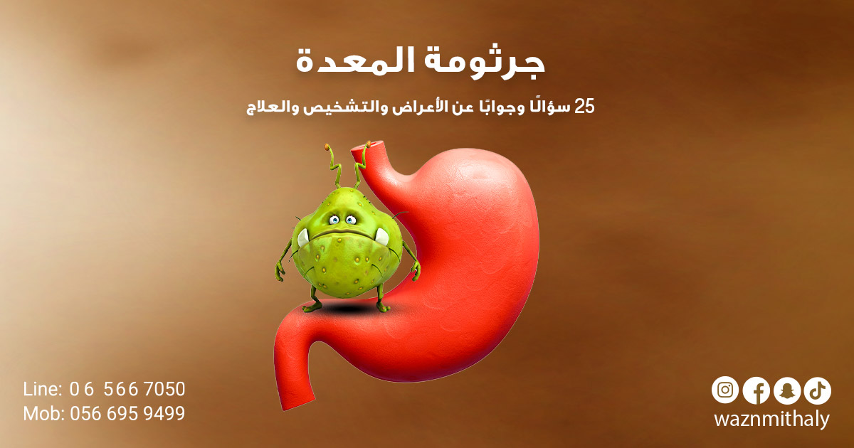 جرثومة المعدة: 25 سؤالًا وجوابًا عن الأعراض والتشخيص والعلاج، دليل مبسّط مع رسم توضيحي