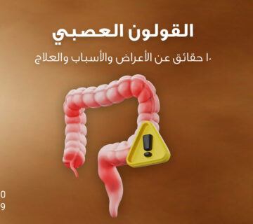 القولون العصبي - 10 حقائق عن الأعراض والأسباب والعلاج من مركز الوزن المثالي الطبي بالشارقة